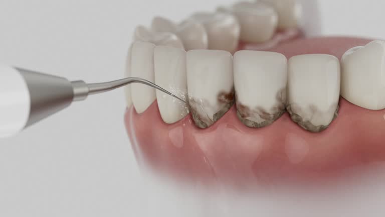 Trusted Dental Implants service in Walnut Creek, CA - Dentist Open Now